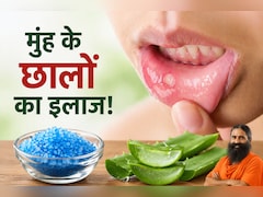 मुंह के छालों से हैं परेशान? बाबा रामदेव ने बताया 2 मिनट का देसी नुस्खा