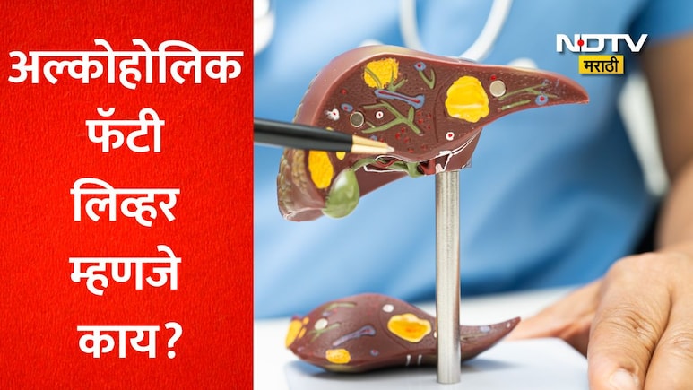 Alcoholic Liver Disease: दारू खराब होती म्हणून लिव्हर खराब झालं? रुग्णाचा अजब दावा, डॉ. सरीन यांचा गंभीर इशारा