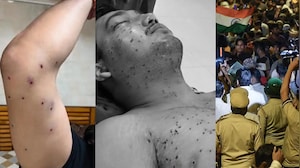 CRPF Orders Probe Into Pellet Gun Allegations During Jantar Mantar Protest