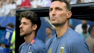 "Left A Mark On Me": Argentina Coach Lionel Scaloni's Honest Admission On Cape Verde Match