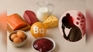 Vitamin B12 की कमी से कौन सी बीमारी होती है? डॉक्टर से जानें कैसे करें इसकी कमी को पूरा