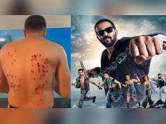 <i>Khatron Ke Khiladi 15</i>: Internet Reacts To Gaurav Khanna's Painful Rubber Bullet Task