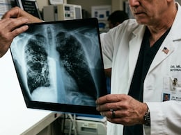What Is Black Lung Disease And Why Are Cases Soaring In West Viginia, USA?