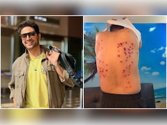 Gaurav Khanna's Injury Video Goes Viral; Khatron Ke Khiladi Maker Breaks Silence On Safety Concerns