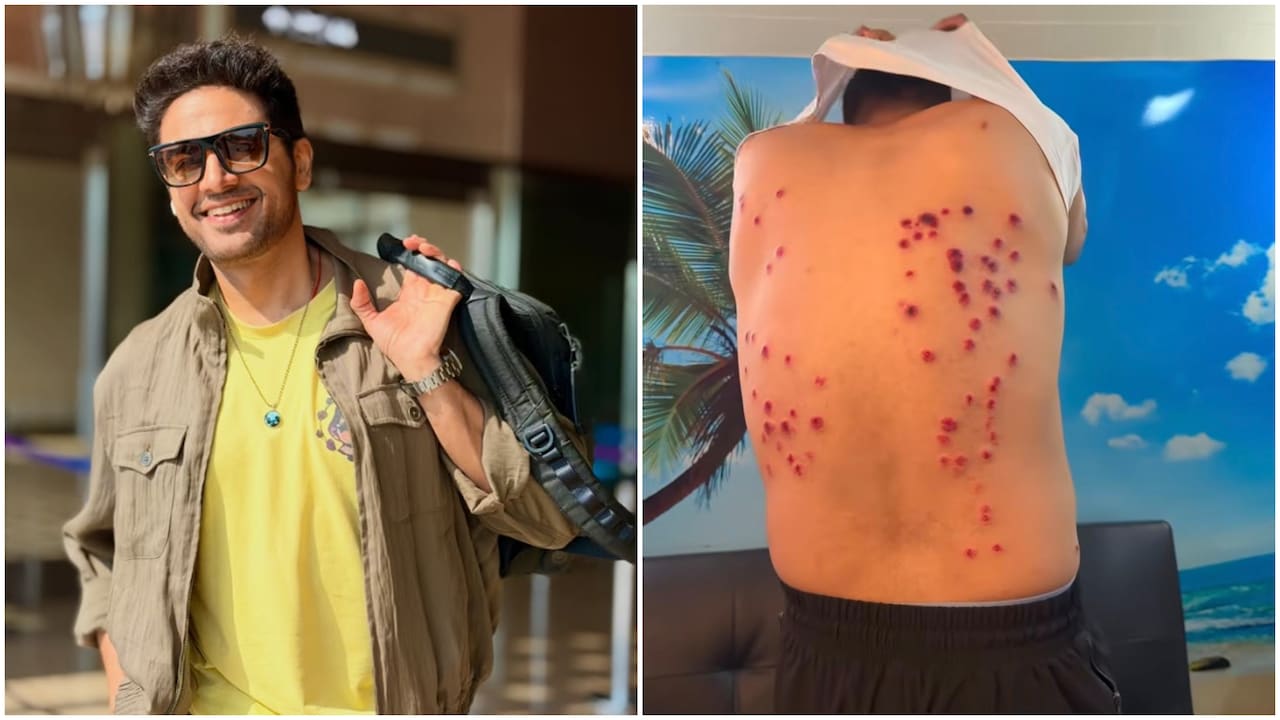 Gaurav Khanna's Injury Video Goes Viral; Khatron Ke Khiladi Maker Breaks Silence On Safety Concerns