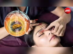 पार्लर में कराते हैं बार-बार थ्रेडिंग? लिवर हो सकता है डैमेज... डॉक्टर ने बताया क्या है वजह