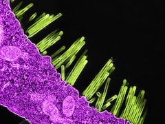 H1N1 Cases Are Rising Again: Symptoms, Risks, Prevention And All You Need To Know