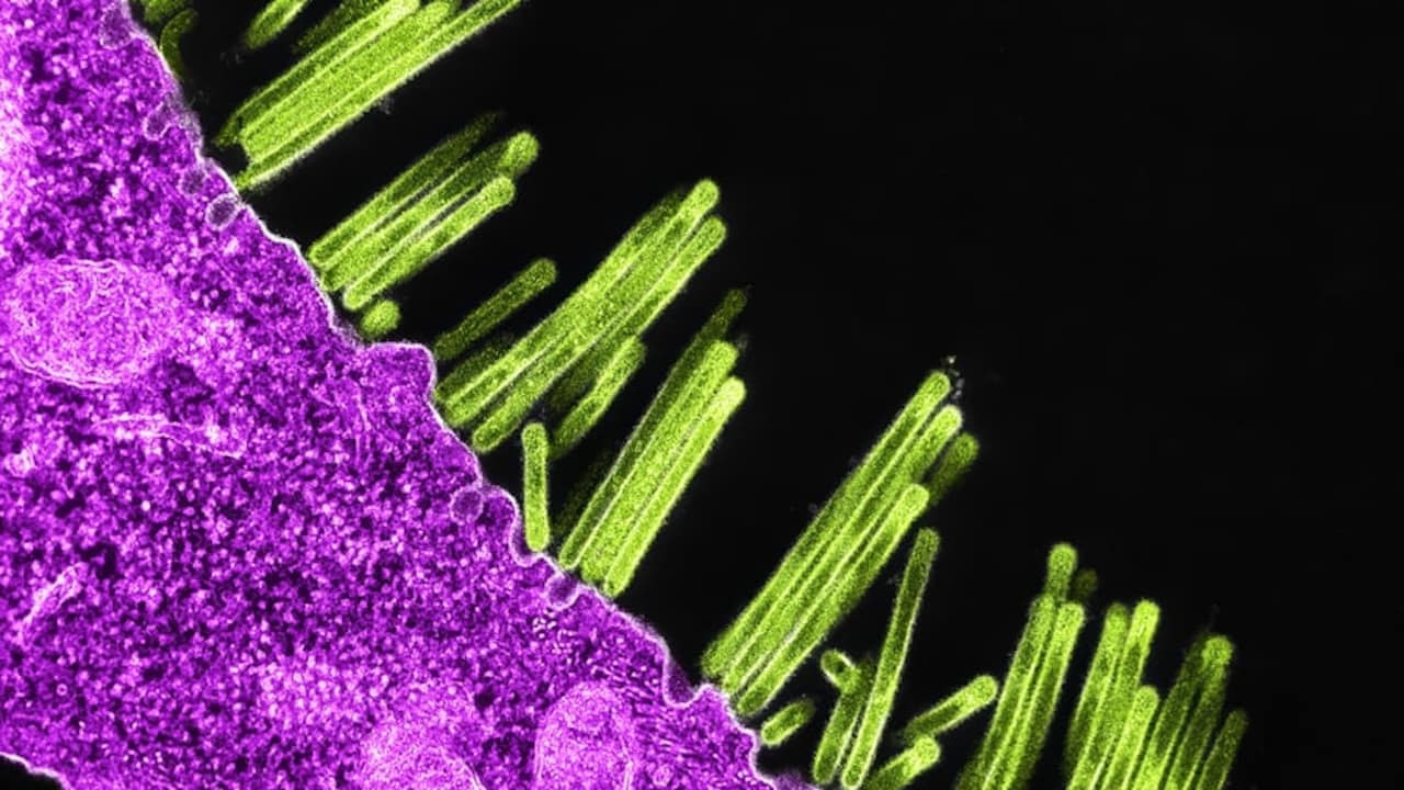 H1N1 Cases Are Rising Again: Symptoms, Risks, Prevention And All You Need To Know