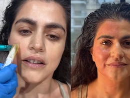 'Paid Someone To Take My Blood': Shehnaz Treasury's Honest Take On Viral Vampire Facial