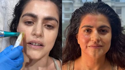 'Paid Someone To Take My Blood': Shehnaz Treasury's Take On Vampire Facial