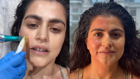 'Paid Someone To Take My Blood': Shehnaz Treasury's Honest Take On Viral Vampire Facial