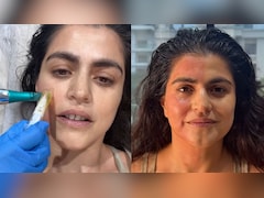 'Paid Someone To Take My Blood': Shehnaz Treasury's Honest Take On Viral Vampire Facial