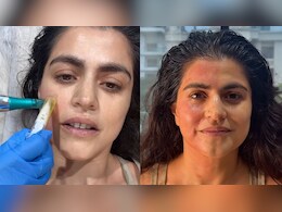 शहनाज ट्रेजरी ने द&zwj;िखाया वायरल वैम्&zwj;पायर फेश&zwj;ियल कैसे होता है, किम कार्दशियन और शाहरुख खान का है पसंदीदा Facial