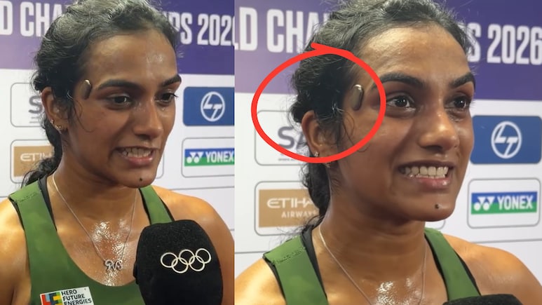 PV Sindhu के माथे पर दिखा अनोखा डिवाइस, Zomato के को-फाउंडर से है खास कनेक्शन, जानें खासियत