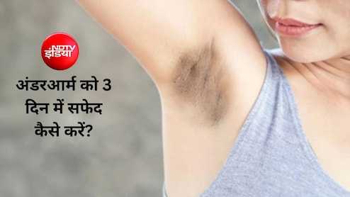 अंडरआर्म को तेजी से सफेद करने के लिए कौन से घरेलू उपाय हैं? 5 म&zwj;िनट में घर पर तैयार करें यह लेप