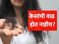 Hair Growth Tips: केसांची वाढ होत नाहीय? तुमच्या शरीरात असू शकते 'या' 3 व्हिटॅमिन्सची भयंकर कमतरता, डॉ. सेठींनी सांगितले सत्य