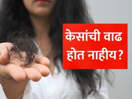 Hair Growth Tips: केसांची वाढ होत नाहीय? तुमच्या शरीरात असू शकते 'या' 3 व्हिटॅमिन्सची भयंकर कमतरता, डॉ. सेठींनी सांगितले सत्य