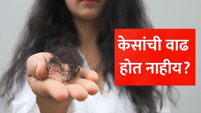 केसांची वाढ होत नाहीय? तुमच्या शरीरात असू शकते 'या' 3 व्हिटॅमिन्सची भयंकर कमतरता, डॉ. सेठींनी सांगितले सत्य