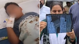 Thane Toddler Given Injection, Sent Home With Broken Needle In Body