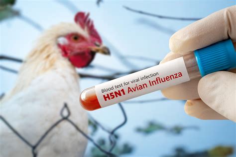 H5N1 bird flu can present itself with symptoms that need medical attention