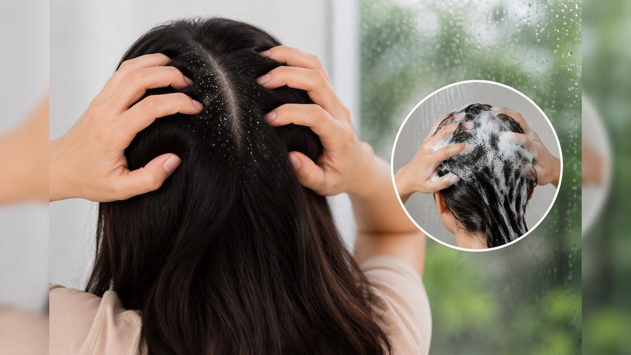 Expert Ki Rai: मानसून में डैंड्रफ से बचने के लिए हफ्ते में कितनी बार बाल धोने चाहिए