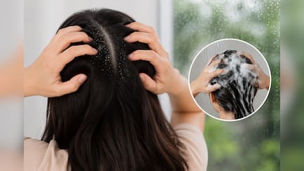 Expert Ki Rai: मानसून में डैंड्रफ से बचने के लिए हफ्ते में कितनी बार बाल धोने चाहिए