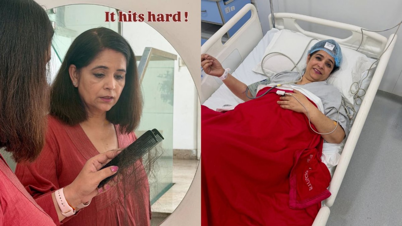 "It Stopped My Breath": MasterChef Pankaj Bhadouria On 'Traumatic' Hair Loss During Chemotherapy