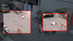 Maharashtra Dog Attack Horror: 2-Year-Old Critical After Pet Dog Mauls Child