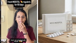 Doctor With PCOS Took Inositol For 60 days: Can It Help Manage The Condition?