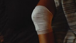 'They Might Amputate My Legs': 29-Year-Old Fights Psoriatic Arthritis - Warning Signs To Watch For