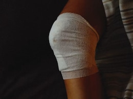 'They Might Amputate My Legs': 29-Year-Old Fights Psoriatic Arthritis - Warning Signs To Watch For