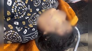 बहन को बोली थी- 'उसने मुझे मारा है', अगले दिन मिली लाश; लिव-इन पार्टनर ने गला दबाकर की हत्या