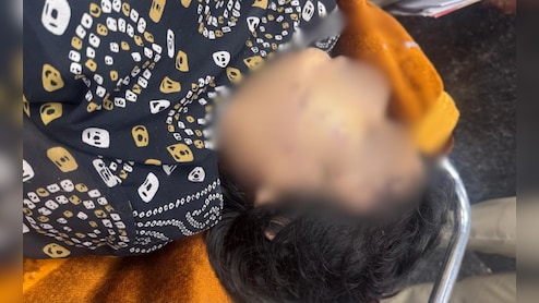 बहन को बोली थी- 'उसने मुझे मारा है', अगले दिन मिली लाश; लिव-इन पार्टनर ने गला दबाकर की हत्या