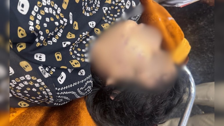 बहन को बोली थी- 'उसने मुझे मारा है', अगले दिन मिली लाश; लिव-इन पार्टनर ने गला दबाकर की हत्या