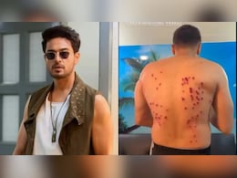 Gaurav Khanna Suffers Bruises From Rubber Bullets On <i>Khatron Ke Khiladi 15</i>, Calls It 'Most Painful Experience'