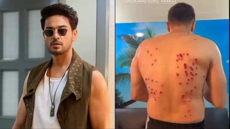 Gaurav Khanna Suffers Bruises From Rubber Bullets On <i>Khatron Ke Khiladi 15</i>, Calls It 'Most Painful Experience'