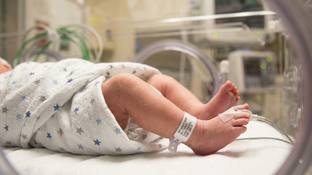 Premature babies are at a higher risk of RSV infection
