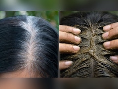 बस 3 महीने तक लगा लें ये 3 हर्ब्स, एक्सपर्ट ने बताया एक-एक सफेद बाल हो जाएगा काला, हेयर ग्रोथ भी होगी तेज