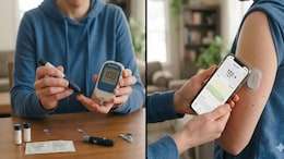Blood Glucose Monitoring vs Continuous Glucose Monitoring: What Should A Diabetic Choose?