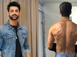 'Went Numb': After Gaurav Khanna, Karan Wahi Reacts To <i>Khatron Ke Khiladi 15's</i> Painful Rubber Bullet Task