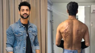 'Went Numb': After Gaurav Khanna, Karan Wahi Reacts To <i>Khatron Ke Khiladi 15's</i> Painful Rubber Bullet Task