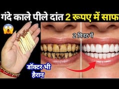 सिर्फ 2 रुपये में गंदे सड़े पीले दांतों को मोती की तरह चमका देगा ये असरदार देसी नुस्खा, मिनटों में दिखेगा असर
