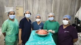 Mumbai News:  46 वर्षीय महिलेच्या गर्भाशयातून काढली 5.5 KG वजनाची गाठ, यामागचं कारण वाचून थक्कच व्हाल