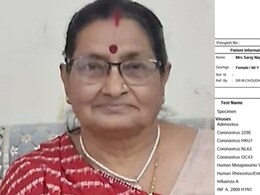 बिना मेडिकल सलाह के स्वाइन फ्लू संक्रमित महिला को किया डिस्चार्ज, CMHO ने भेजा अस्पताल को नोटिस, जांच टीम गठित