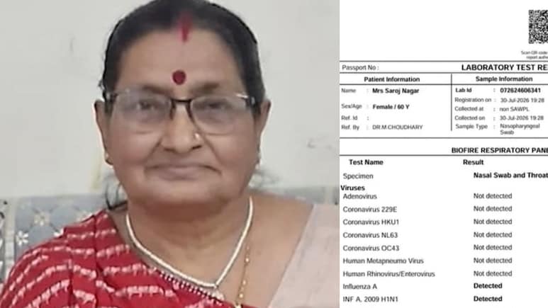 बिना मेडिकल सलाह के स्वाइन फ्लू संक्रमित महिला को किया डिस्चार्ज, CMHO ने भेजा अस्पताल को नोटिस, जांच टीम गठित