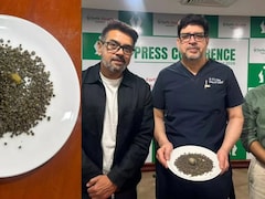 गॉल ब्‍लेडर में 4000 से ज्यादा पथरी और 46 BMI वाला मरीज! फरीदाबाद के फोर्टिस अस्पताल में डाक्टरो ने ऐसे बचाई जान