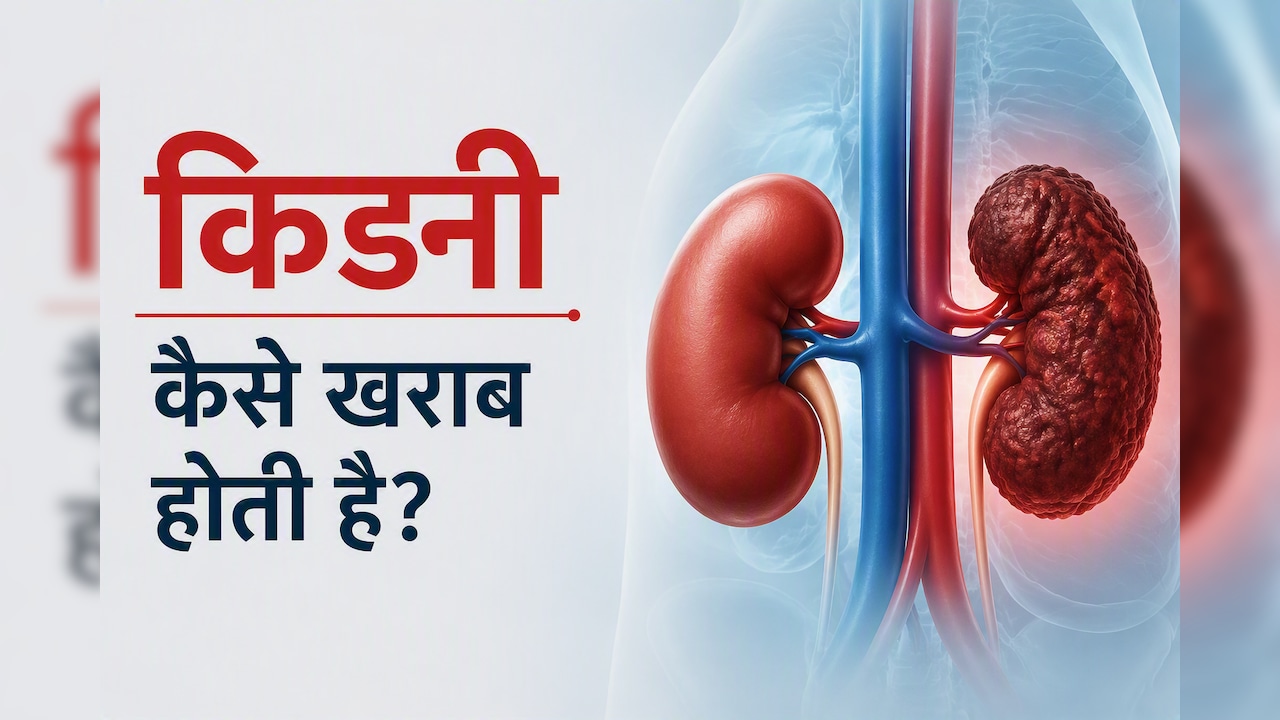 Kidney Kharab Kaise Hoti Hai: आपकी ये 5 गलतियां किडनी को कर रही हैं खराब, डॉक्टर की चेतावनी