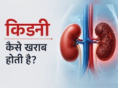 Kidney Kharab Kaise Hoti Hai: आपकी ये 5 गलतियां किडनी को कर रही हैं खराब, डॉक्टर की चेतावनी