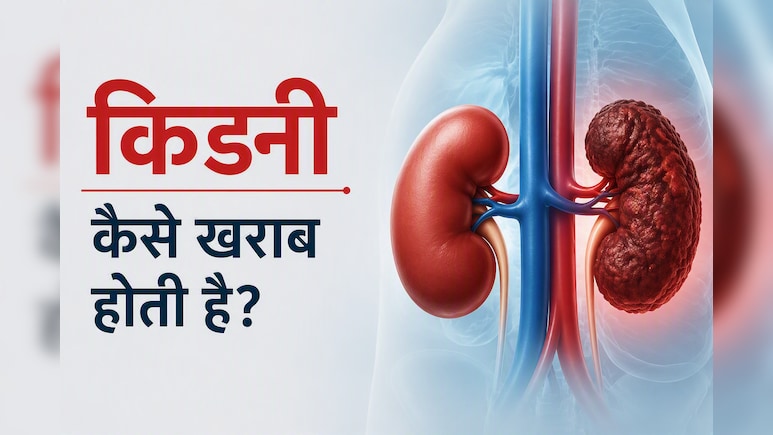 Kidney Kharab Kaise Hoti Hai: आपकी ये 5 गलतियां किडनी को कर रही हैं खराब, डॉक्टर की चेतावनी