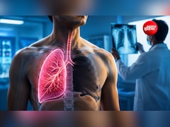 क्या कोई व्यक्ति पूरी जिंदगी 1 लंग्स के सहारे जी सकता है? डॉक्टर का जवाब जानकर हो सकते हैं हैरान